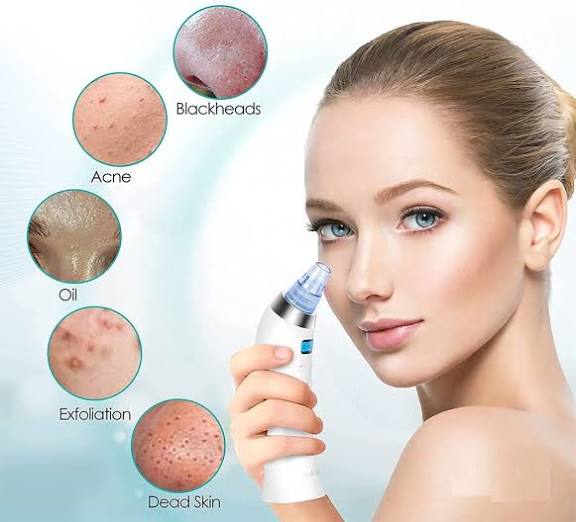 Derma Suction Blackhead Remover Vacuum Suck The Yuck Out Of Your Pores (cell Operated)